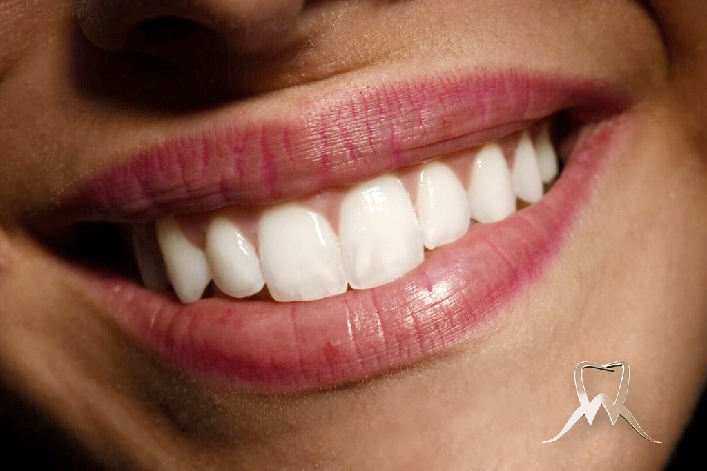 AlpedentalSmile_v2gold